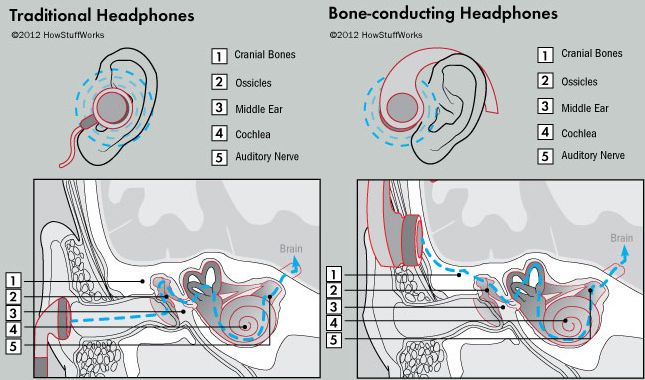 Écouteurs Bone conduction
